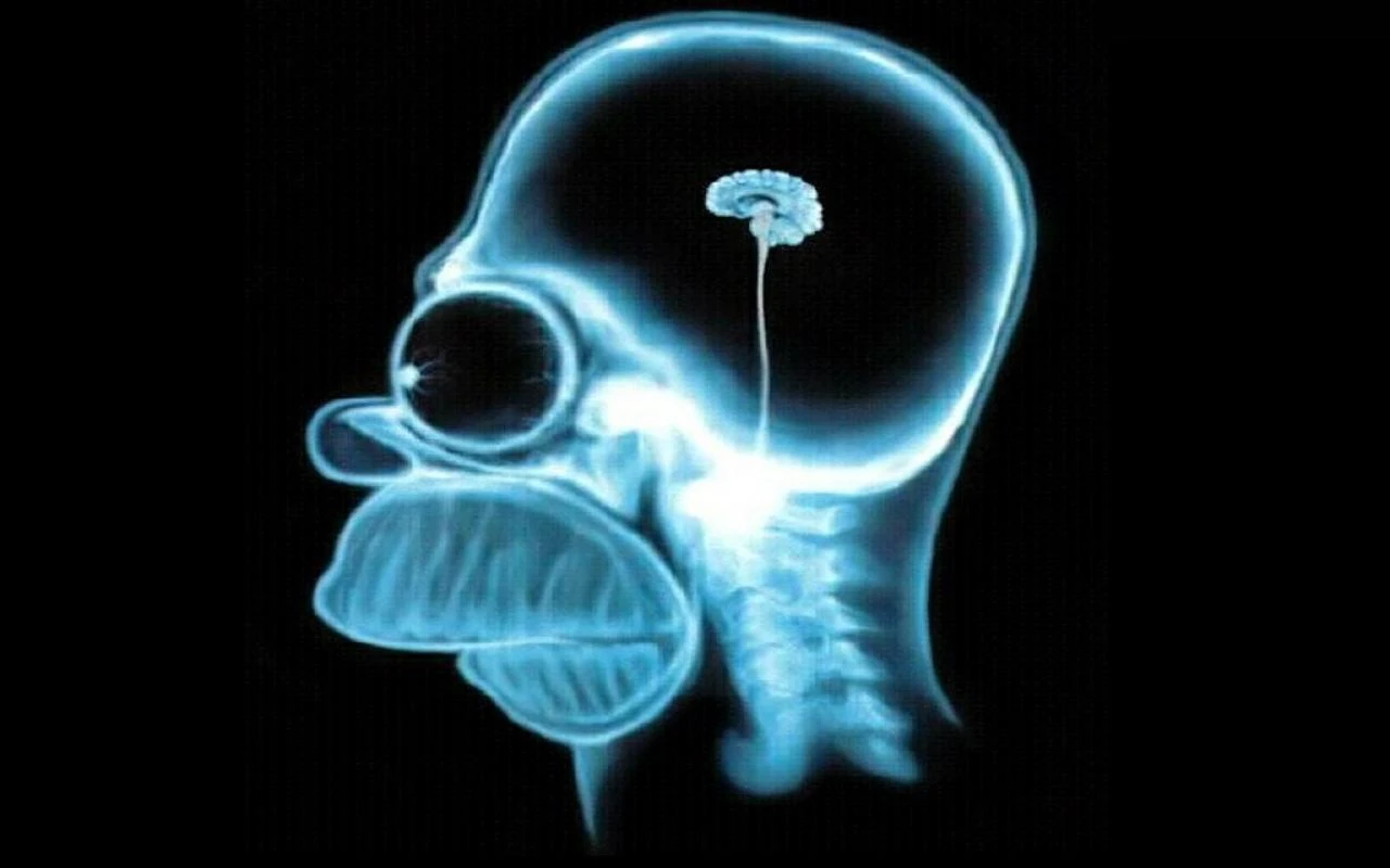 Homer Simpson X-ray photo with a mini brain CC BY-SA